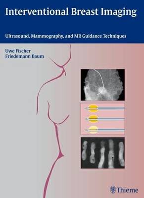 Interventional Breast Imaging: Ultrasound, Mammography, and Mr Guidance Techniques by Uwe Fischer image