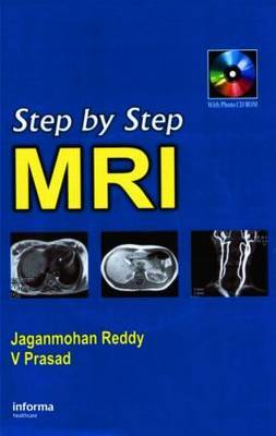 Step by Step Pediatric MRI by PRASAD image