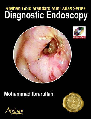 Mini Atlas of Diagnostic Endoscopy by Mohammad Ibrarullah image