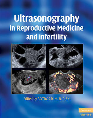 Ultrasonography in Reproductive Medicine and Infertility on Hardback