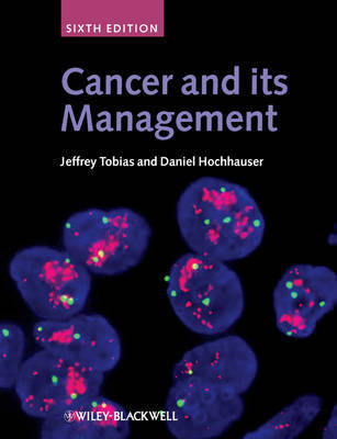 Cancer and Its Management image