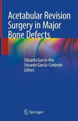 Acetabular Revision Surgery in Major Bone Defects image