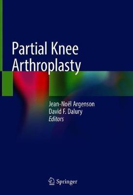 Partial Knee Arthroplasty image