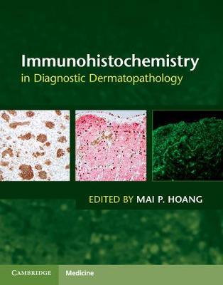 Immunohistochemistry in Diagnostic Dermatopathology image