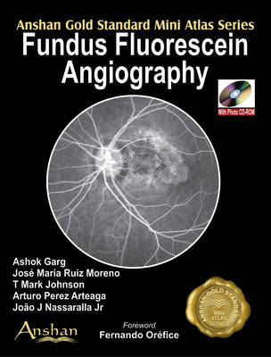 Mini Atlas of Fluorescein Angiography by Venktatesh image