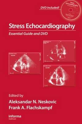 Stress Echocardiography image