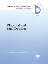 fetal doppler nz