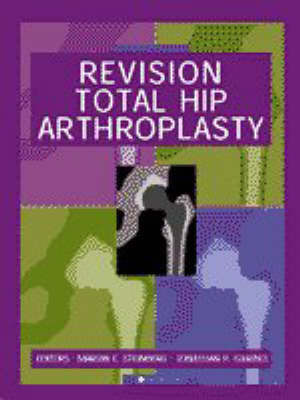 Revision Total Hip Arthroplasty by Marvin E. Steinberg image