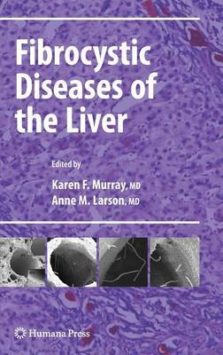 Fibrocystic Diseases of the Liver image