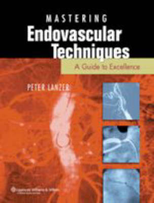 Mastering Endovascular Techniques image