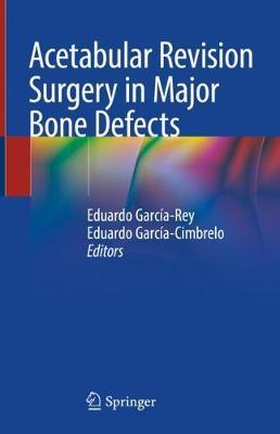 Acetabular Revision Surgery in Major Bone Defects image