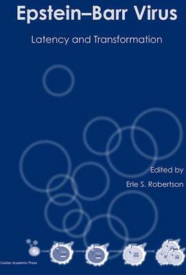 Epstein-Barr Virus on Hardback