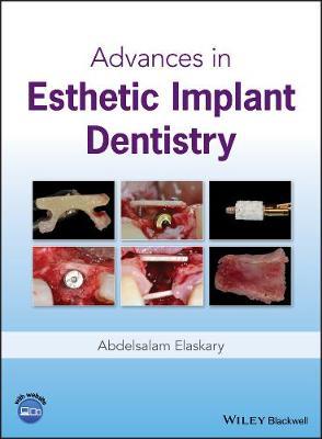 Advances in Esthetic Implant Dentistry by Abdelsalam Elaskary image