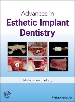 Advances in Esthetic Implant Dentistry image