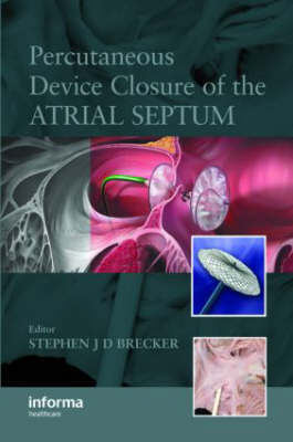 Percutaneous Device Closure of the Atrial Septum image
