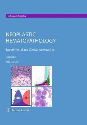 Neoplastic Hematopathology on Hardback