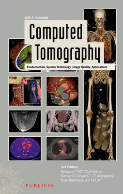 Computed Tomography on Hardback by Willi A. Kalender