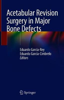 Acetabular Revision Surgery in Major Bone Defects image