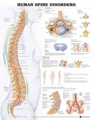 Human Spine Disorders Anatomical Chart image