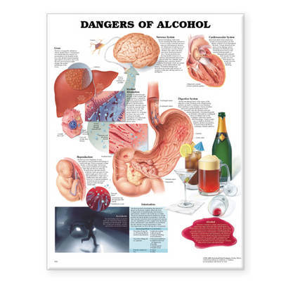 Dangers of Alcohol Anatomical Chart image