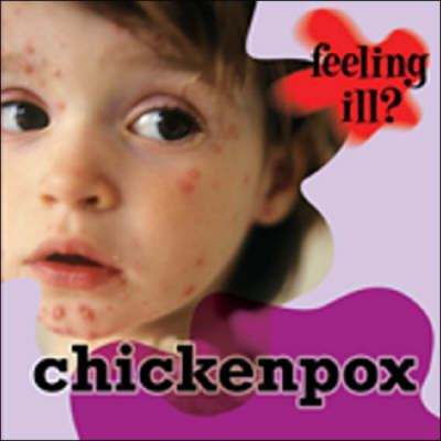 Chicken Pox by Jillian Powell image
