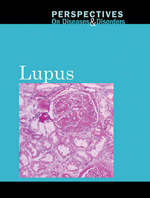 Lupus image