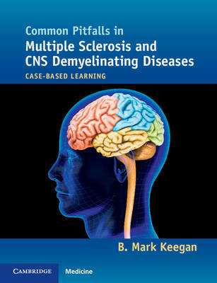 Common Pitfalls in Multiple Sclerosis and CNS Demyelinating Diseases by B. Mark Keegan image