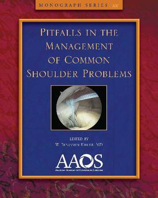 Pitfalls in the Management of Common Shoulder Problems image