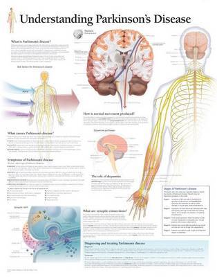 Understanding Parkinsons