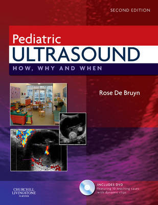 Pediatric Ultrasound: How, Why and When on Hardback