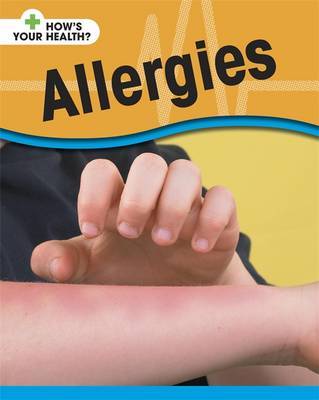 Allergies by Angela Royston image