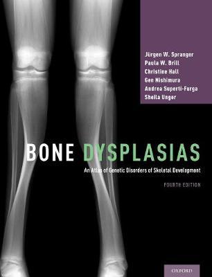Bone Dysplasias by Jurgen W. Spranger image