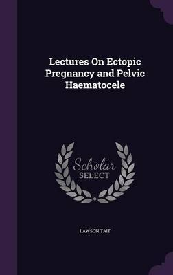Lectures on Ectopic Pregnancy and Pelvic Haematocele by Lawson Tait image