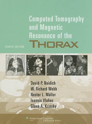 Computed Tomography and Magnetic Resonance of the Thorax by Monvadi B. Srichai image