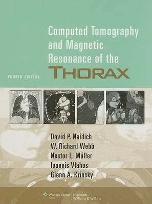 Computed Tomography and Magnetic Resonance of the Thorax on Hardback by Monvadi B. Srichai