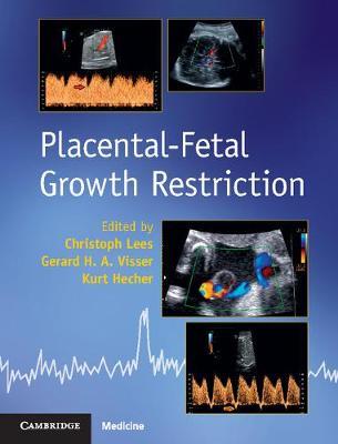 Placental-Fetal Growth Restriction image