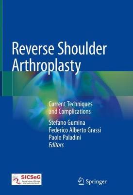 Reverse Shoulder Arthroplasty image