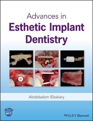Advances in Esthetic Implant Dentistry by Abd El Salam El Askary image