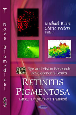 Retinitis Pigmentosa image