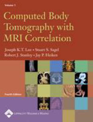 Computed Body Tomography with MRI Correlation image