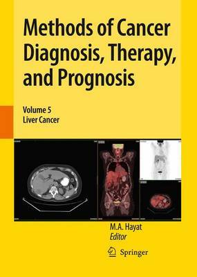Methods of Cancer Diagnosis, Therapy, and Prognosis image
