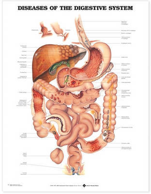 Diseases of the Digestive System Anatomical Chart image