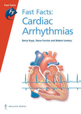 Fast Facts: Cardiac Arrhythmias on Paperback by Gerry Kaye