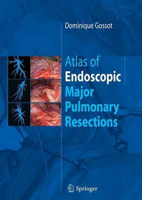 Atlas of endoscopic major pulmonary resections by Dominique Gossot