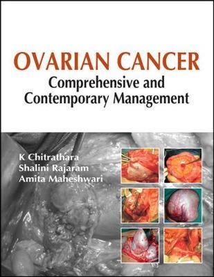 Ovarian Cancer: Comprehensive and Contemporary Management by K. Chitrathara image