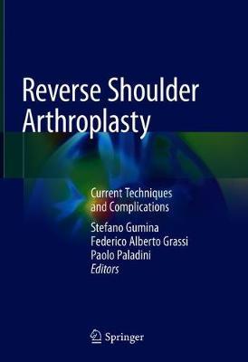 Reverse Shoulder Arthroplasty image