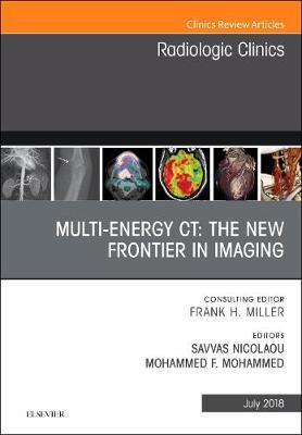 Multi-Energy CT: The New Frontier in Imaging, An Issue of Radiologic Clinics of North America by Savvas Nicolaou image