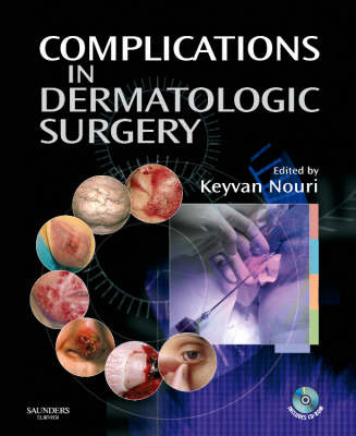 Complications in Dermatologic Surgery by Keyvan Nouri image