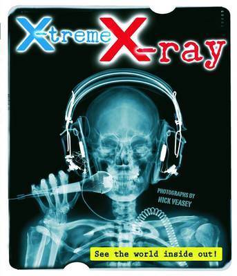 X-Treme X-Ray image