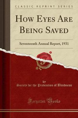 How Eyes Are Being Saved by Society for the Prevention of Blindness image